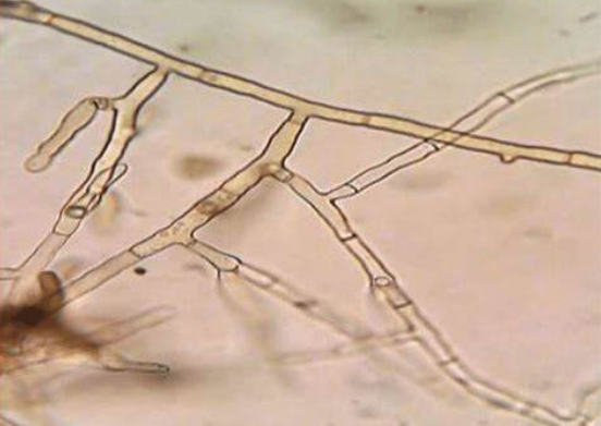  p data-id="go04hdnqfb">扁豆立枯病是由立枯丝核菌引起的,发生在 a