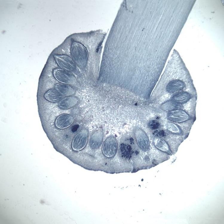  p>子囊菌亚门(ascomycotina) 真菌门中最大的一亚门.