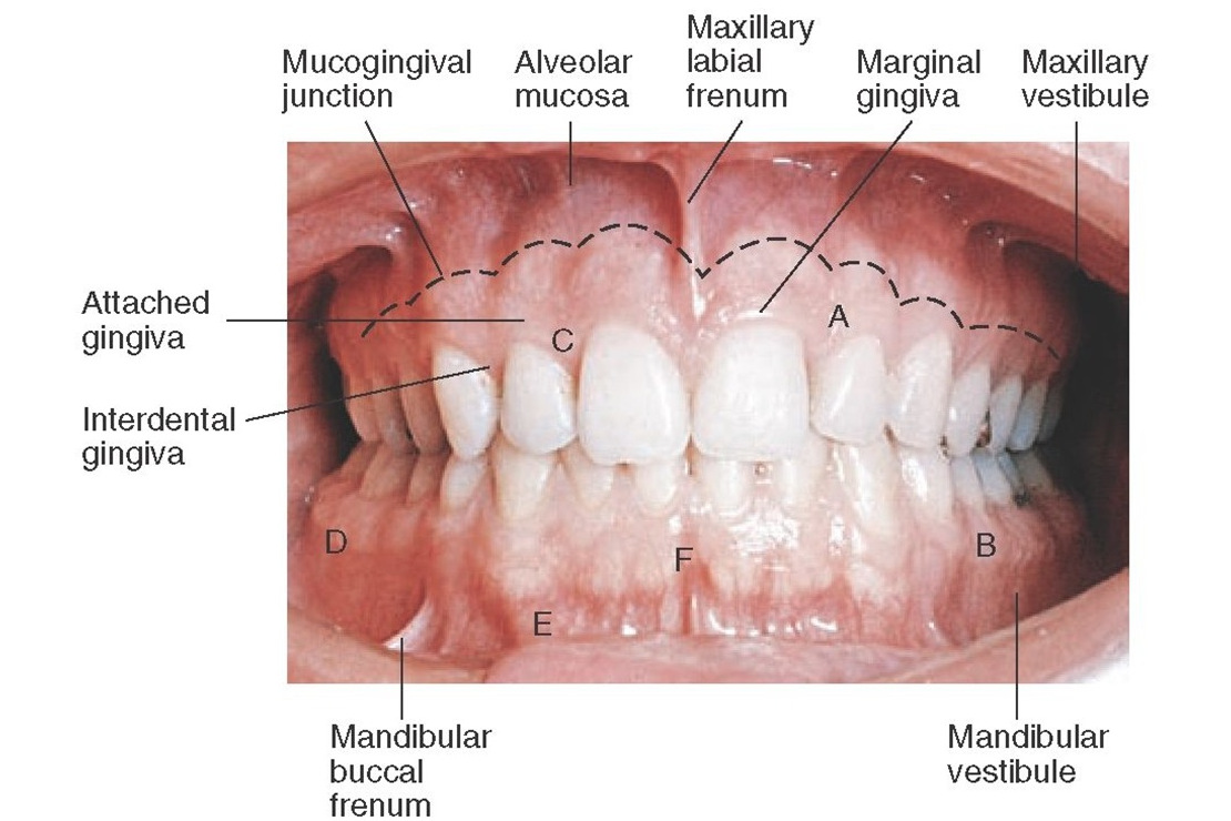 是被游离龈沟同 a target="_blank" href="/item/附着龈
