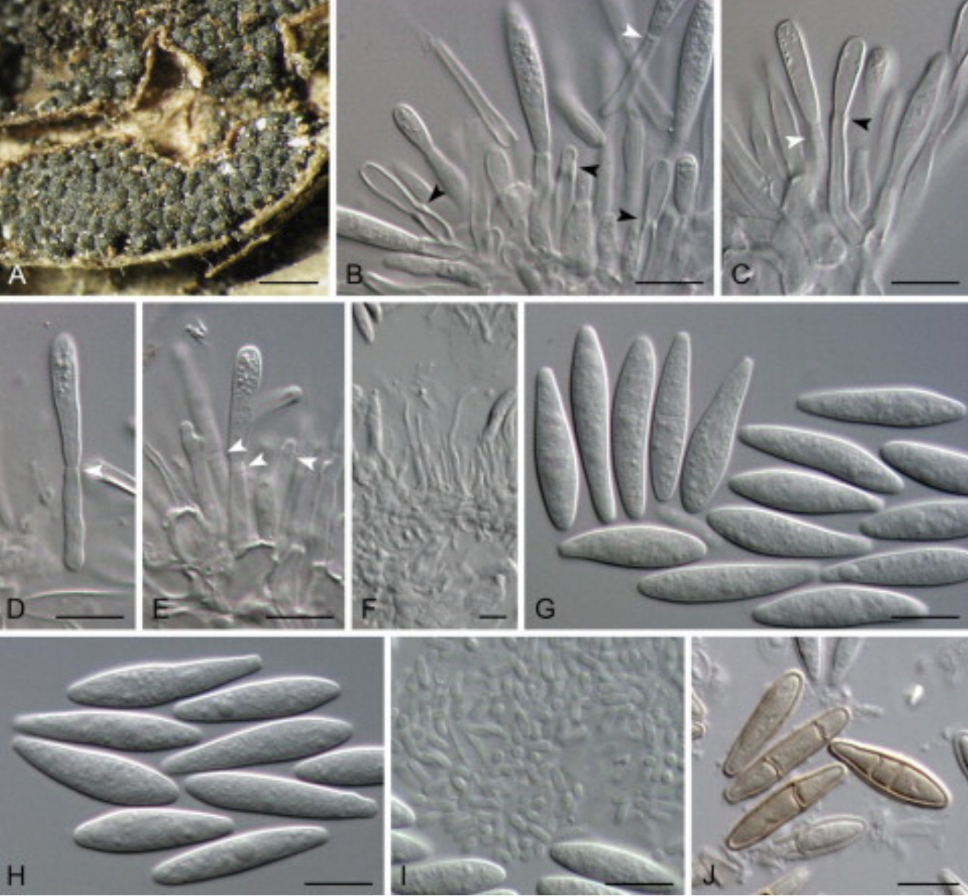  p>葡萄溃疡病是由 a target="_blank" href="/item/葡萄座腔菌