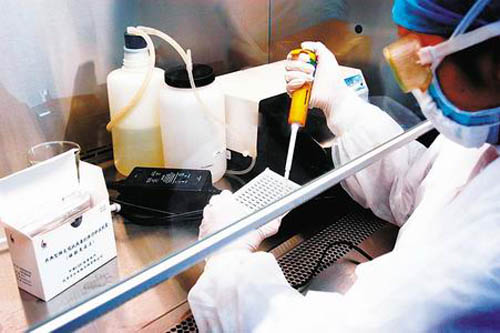  p>特异性抗体检测的目的首先是协助 a href="#" data-lemmaid="