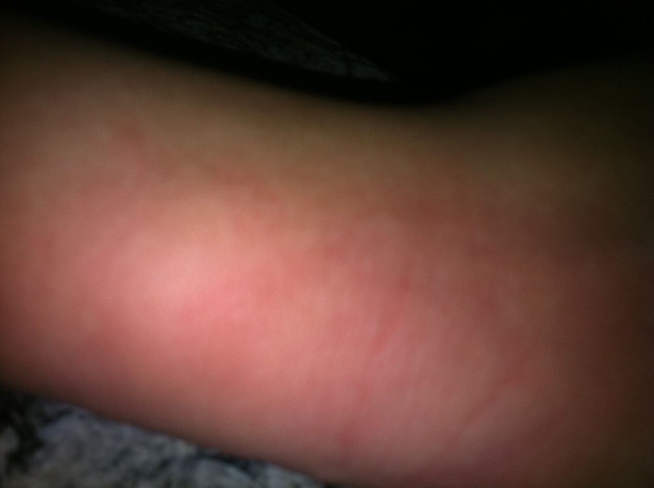  p>壁虎是蜥蜴的一种,又称"守宫".