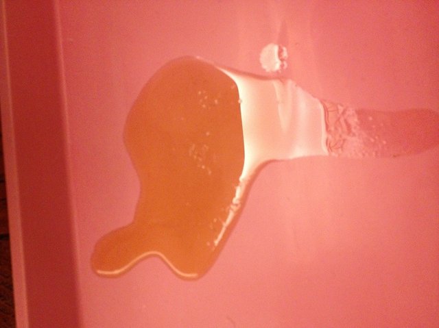 颜色变为红色,尿中含有血液称 a target="_blank" href="/item/血尿