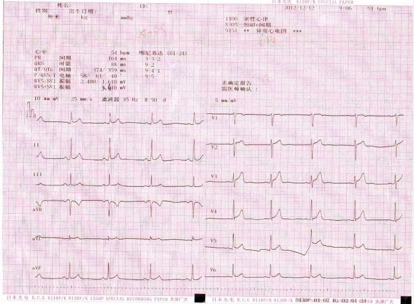  p data-id="gncn50sas5">qtc间期是按心率校正的 a target="_blank"