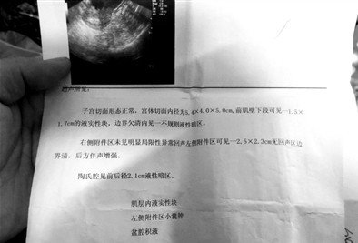 data-lemmaid="15913722">计划生育服务 /a>指导站做结扎手术后死亡