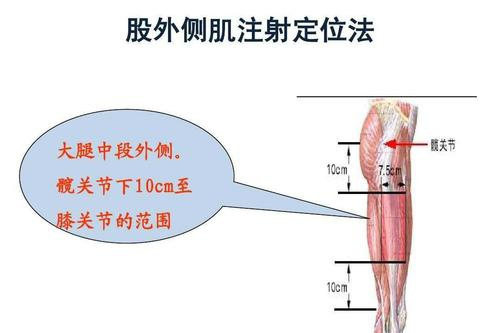 股外侧肌注射术