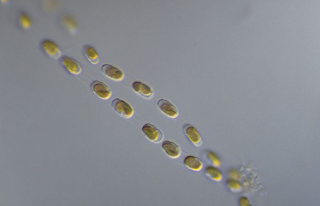  p>中肋骨条藻隶属硅藻门,中心硅藻纲, a href="#" data-lemmaid="