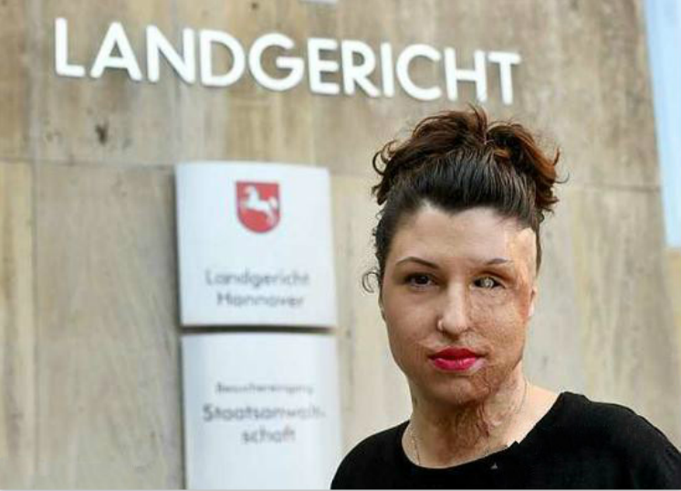 凡妮莎·纽斯特曼,德国人,居住在汉诺威