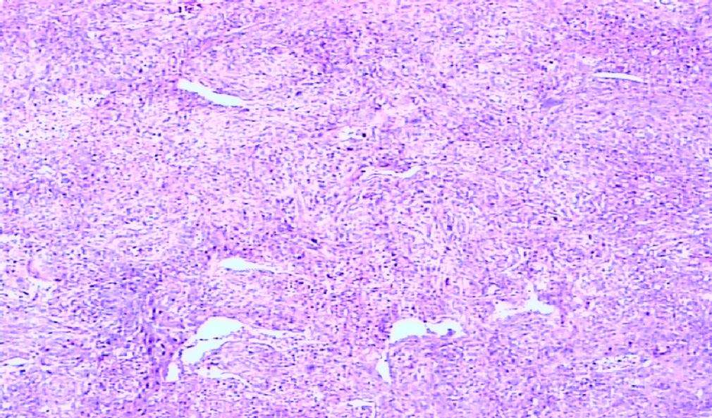 p data-id="gnwqahe2sp">纤维组织是多晶体金属经冷变形后,用光学 a