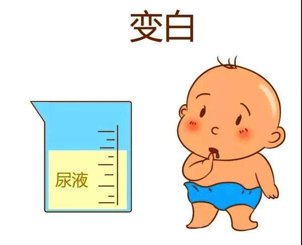 常见的是乳糜尿,为白色乳糜样尿液,见于丝虫病或其它原因引起的肾周围