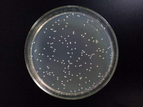 escherichia coli