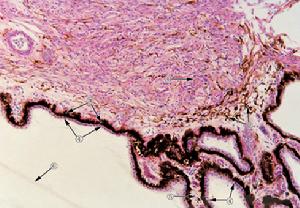 小带或晶状体悬器)与晶状体囊相连在睫状体内有平滑肌,称睫状肌(cil