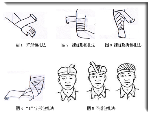 包扎法