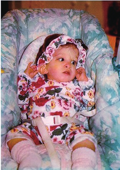 yr">布鲁克·格林伯格,被称为是美国马里兰州巴尔的摩市的"不老女婴"