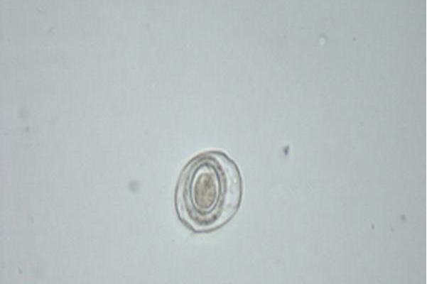 微小膜壳绦虫卵