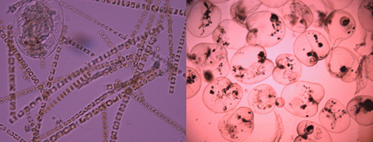  p>中肋骨条藻隶属硅藻门,中心硅藻纲, a href="#" data-lemmaid="
