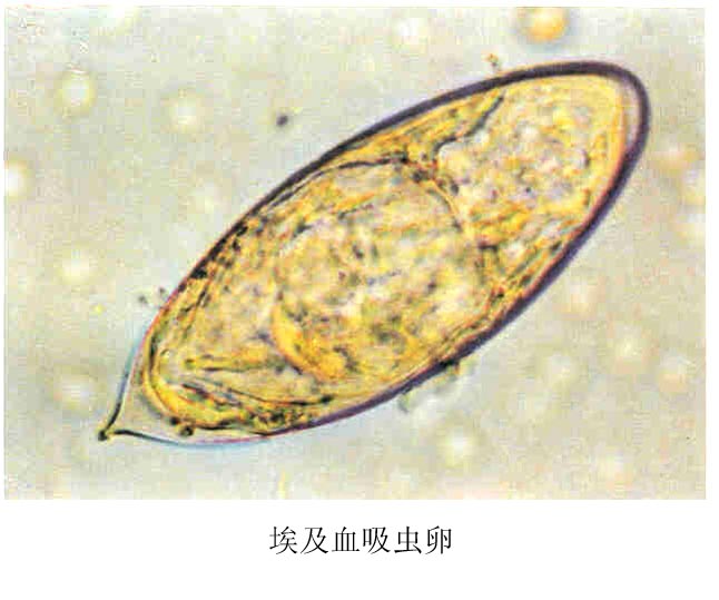 埃及血吸虫