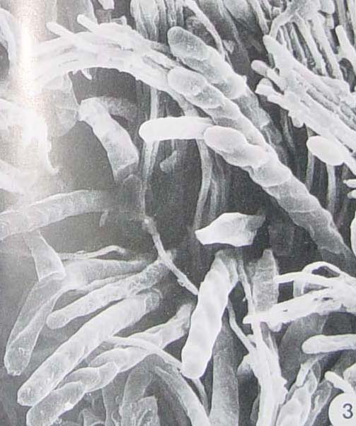  p>核盘菌属,菌核由黑色的外层和白色的髓部组成,不含寄主组织残余物