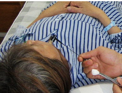  p>电梅花针疗法是一种电灼疗法,适用于疣, a target="_blank" href="