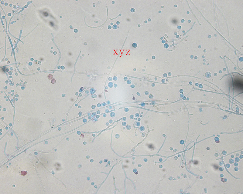  p>浅部真菌主要为皮肤丝状菌(dermatophytes),侵犯 a target="_blank
