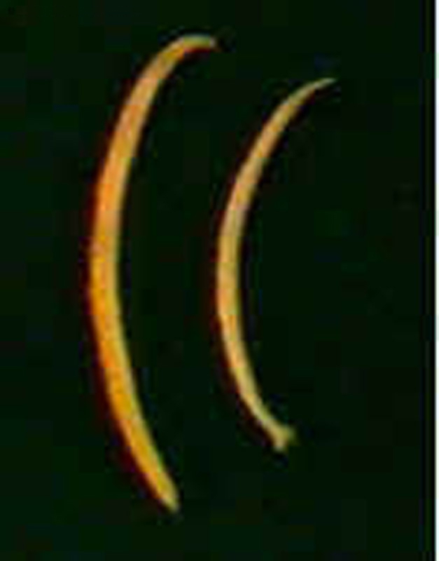  p>十二指肠钩口线虫(ancylostoma duodenale),简称为十二指肠钩虫,寄