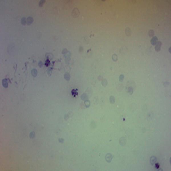  p>伯氏疟原虫是疟原虫科,疟原虫属微生物. /p>