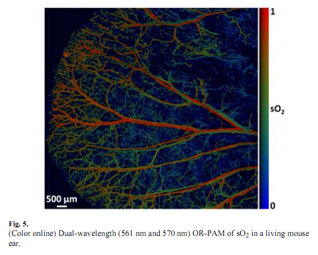  p>光声成像(photoacoustic imaging, pai)是近年来发展起来的一种非