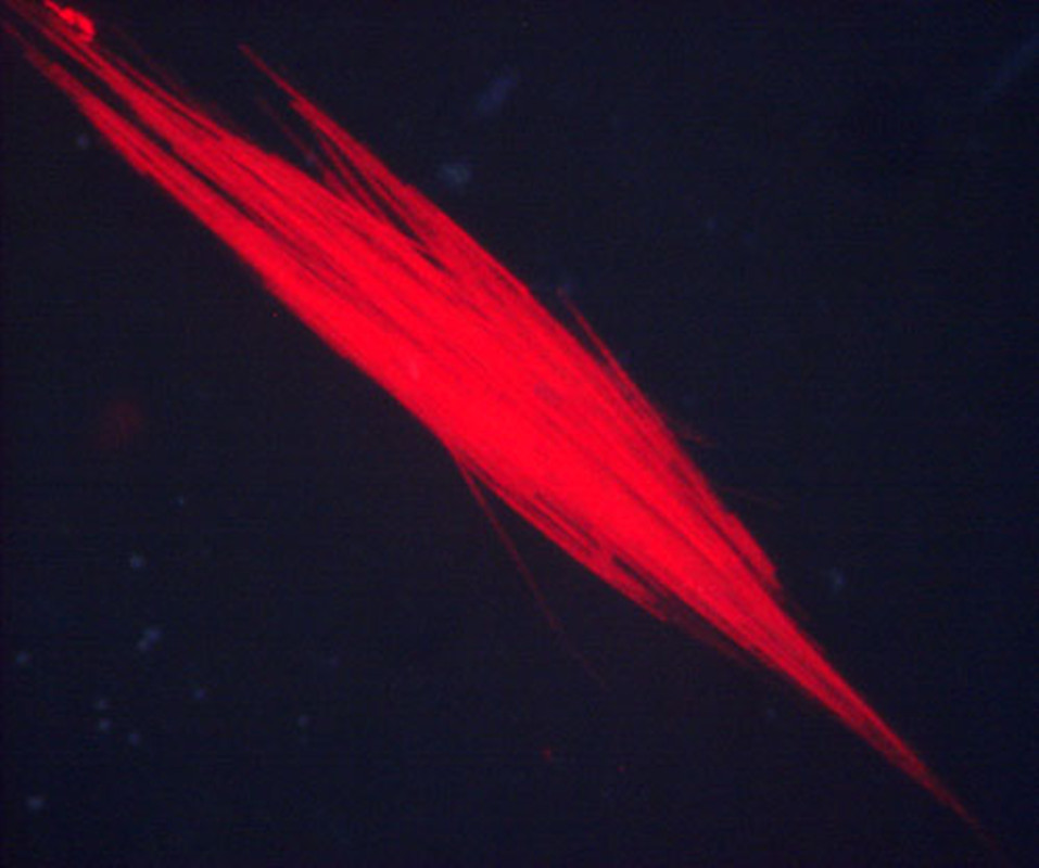  p>水华束丝藻( aphanizomenon flosaquae)分布广泛,淡水水域. /p>