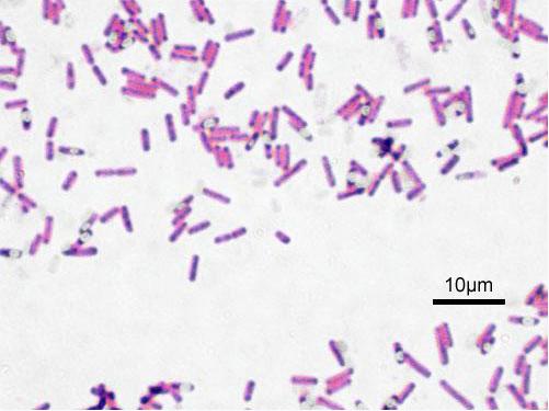  p> a href="#" data-lemmaid="9492941">芽孢杆菌属 /a>( i>bacillus