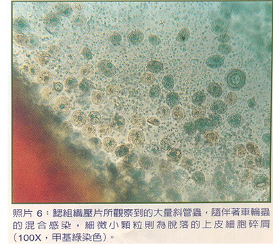 非游斜管虫