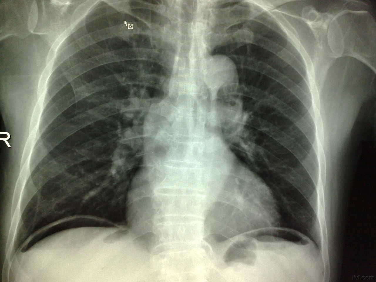  p data-id="gnwt42il5i"> a target="_blank" href="/item/胃穿孔