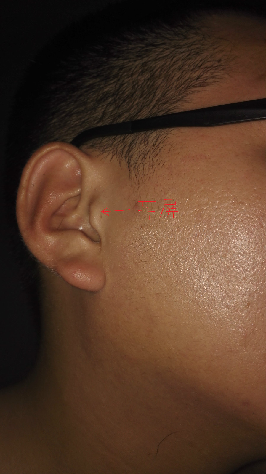  p>耳屏是指 a target="_blank" href="/item/外耳门/53570913" data