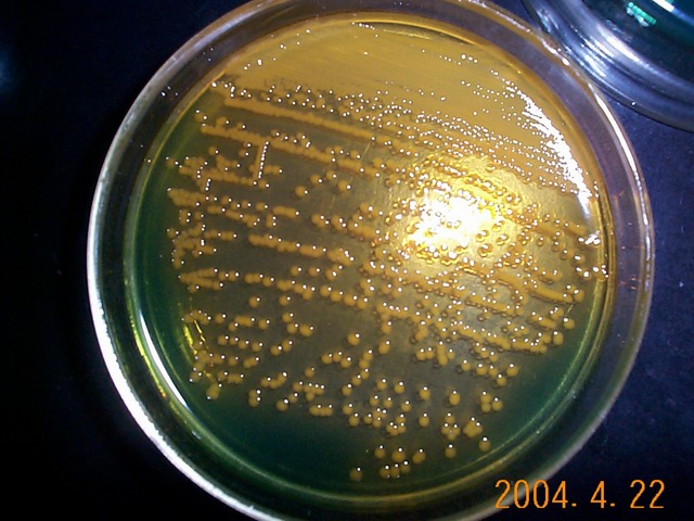 biological pollution of water bodies