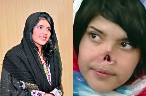 id="gnfe1y1ktm">比比·爱莎("割鼻女孩",bibi aisha)是一名阿富汗人 