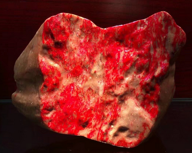  /a>形成的形状不一般的 a target="_blank" href="/item/石头/805"