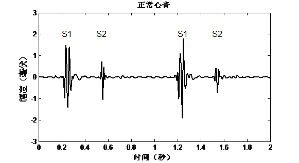  p>通俗地讲,"心音(heart sounds,cardiac sounds)