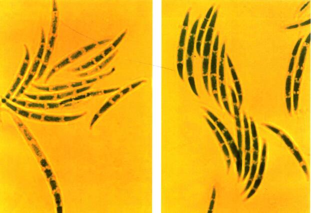  p>小麦赤霉病又称烂穗病,麦秸枯,烂麦头,红麦头,红头瘴,是由多种镰刀