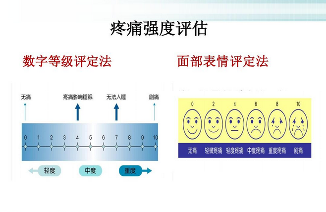 口述分级评分法(vrs),数字评分法(nrs)和恒定疼痛强