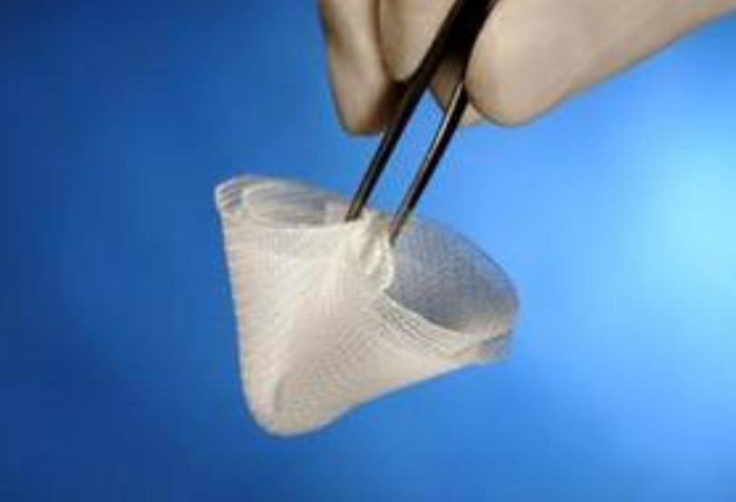 疝修补片