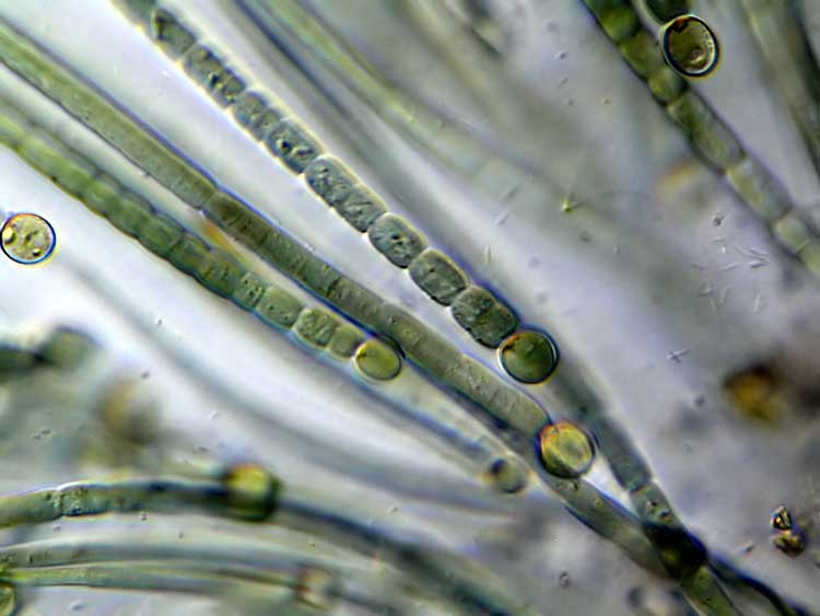  p>蓝藻是最简单,也是最原始的绿色自养植物类群.