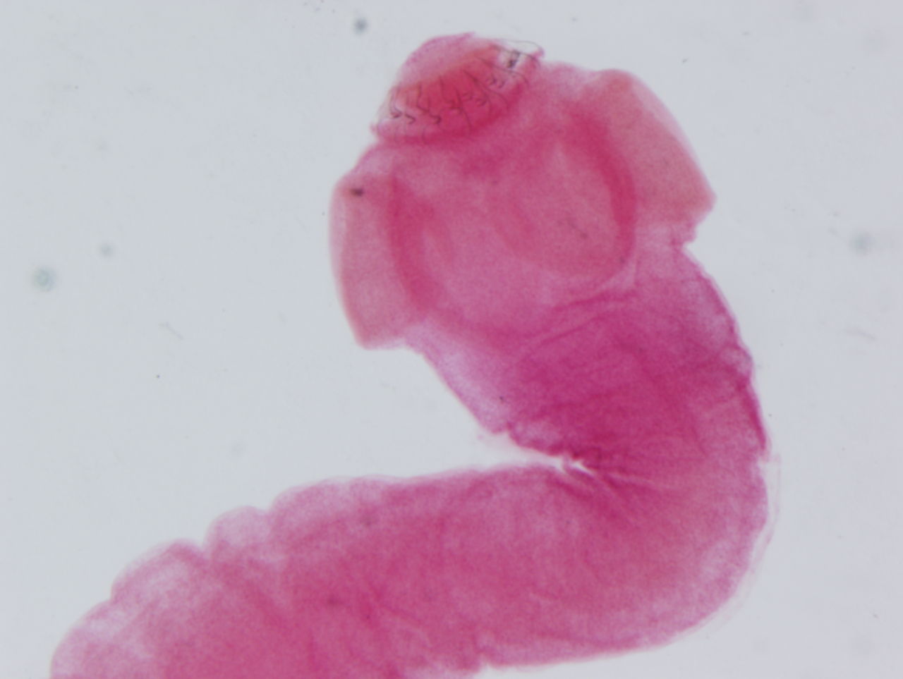  p data-id="tijx09necbry">囊尾蚴是圆叶目带科带属扁形动物猪带绦虫