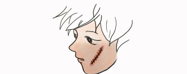 伤口怎么画 - 知晓星球