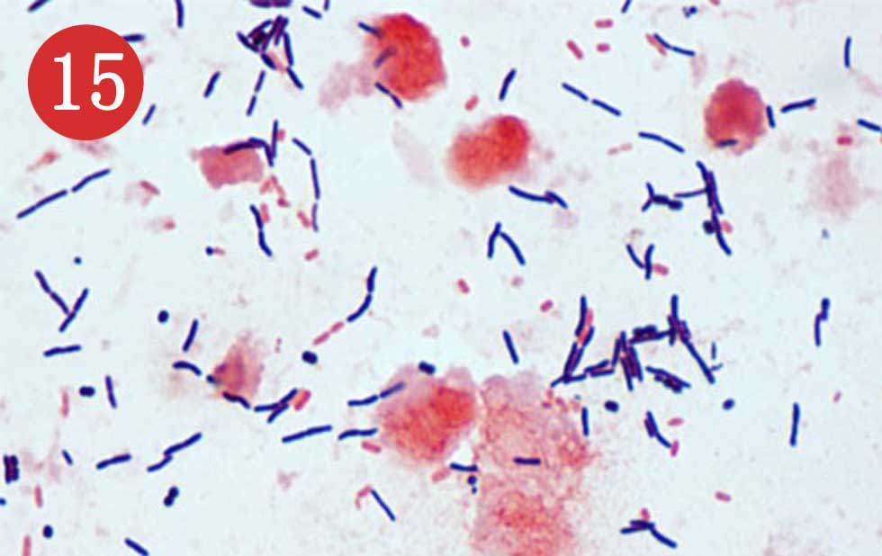 clostridium difficile