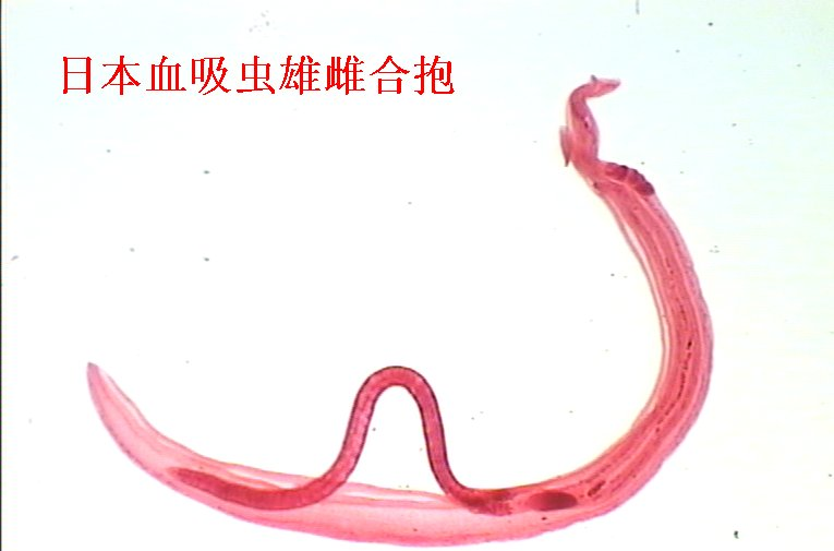  p>日本血吸虫( i>schistosoma japonicum /i> katsurada,1904) 即 a