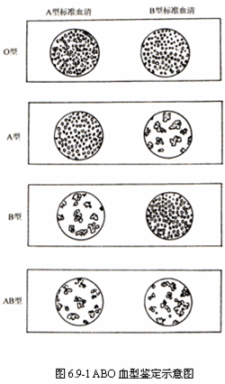 血型/94167" data-lemmaid="94167">血型 /a>",是指"abo式"的血型,这