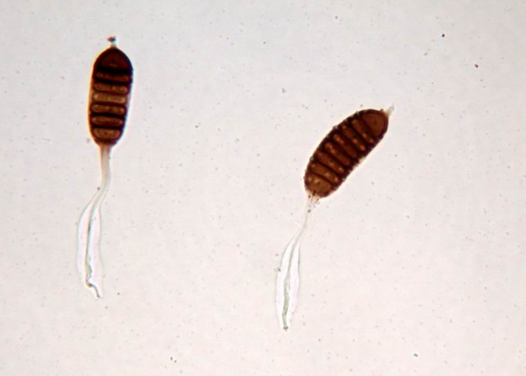  p>柄锈科(学名:pucciniaceae),是柄锈菌纲(学名:pucciniomycetes)