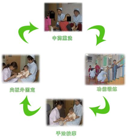 内翻足