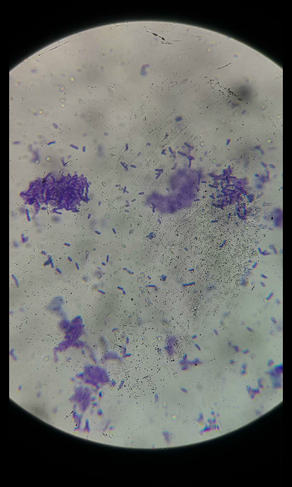  p>枯草芽孢杆菌( i>bacillus subtilis /i>),是 a href="#" data