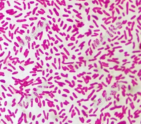 革兰氏阴性杆菌