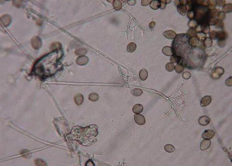  p>节瓜霜霉病是由古巴假霜霉菌引起的,发生在 a target="_blank"